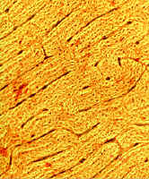 bones.jpg (70994 bytes)